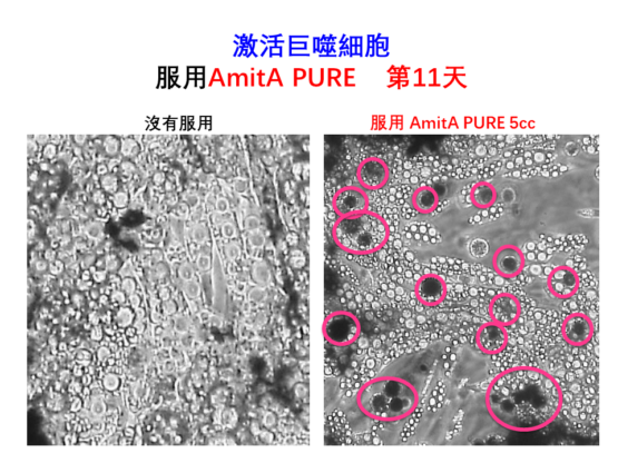 AmitA PURE 增殖巨噬細胞